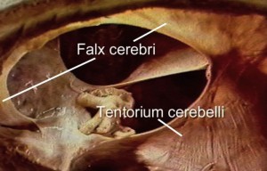 Falx cerebri und Tentorium cerebelli