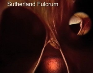 Sutherland Fulcrum