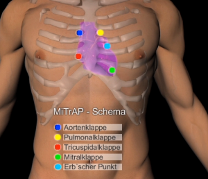 Herz-Kreislauf MITRAP-Schema