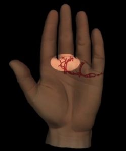 Abbildung 10: Herzlinienende mit kreuzenden Aufwärtslinien nach dem Mittelfinger. Fehlende oder kleine Nagelmonde.